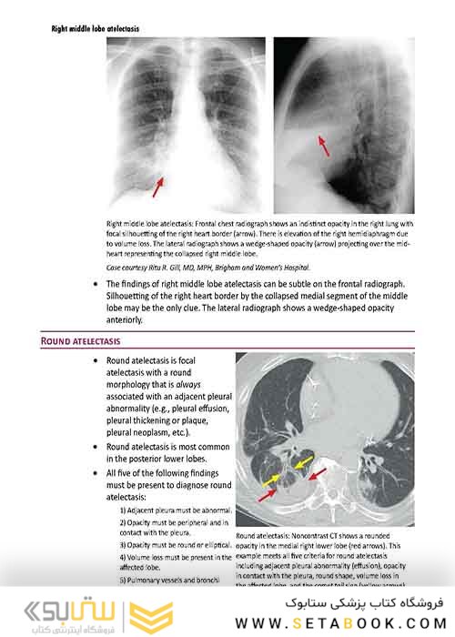 Core Radiology: A Visual Approach to Diagnostic Imaging 1st Edition 2013رادیولوژی هسته