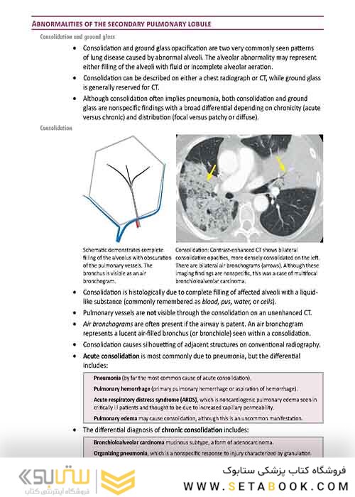 Core Radiology: A Visual Approach to Diagnostic Imaging 1st Edition 2013رادیولوژی هسته