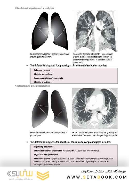 Core Radiology: A Visual Approach to Diagnostic Imaging 1st Edition 2013رادیولوژی هسته