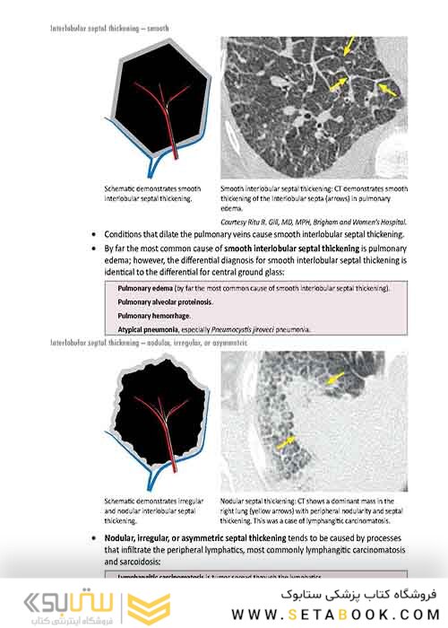 Core Radiology: A Visual Approach to Diagnostic Imaging 1st Edition 2013رادیولوژی هسته