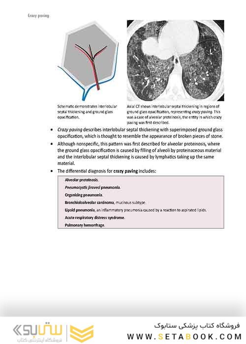 Core Radiology: A Visual Approach to Diagnostic Imaging 1st Edition 2013رادیولوژی هسته