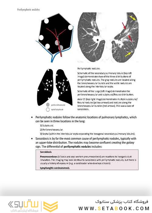 Core Radiology: A Visual Approach to Diagnostic Imaging 1st Edition 2013رادیولوژی هسته