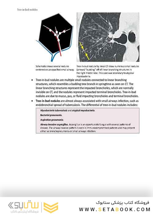 Core Radiology: A Visual Approach to Diagnostic Imaging 1st Edition 2013رادیولوژی هسته