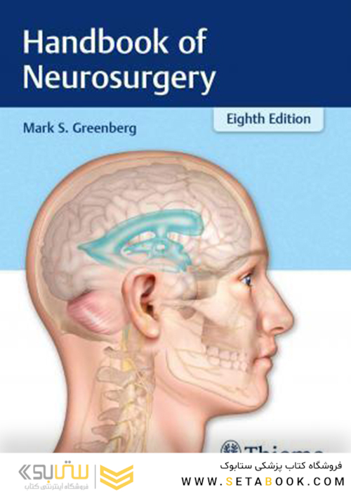 Handbook of Neurosurgery