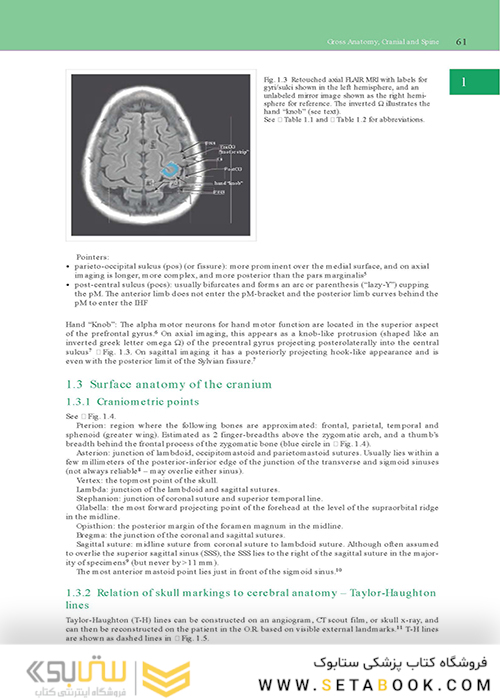 Handbook of Neurosurgery