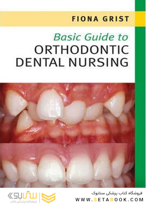 Basic Guide to Orthodontic Dental Nursing