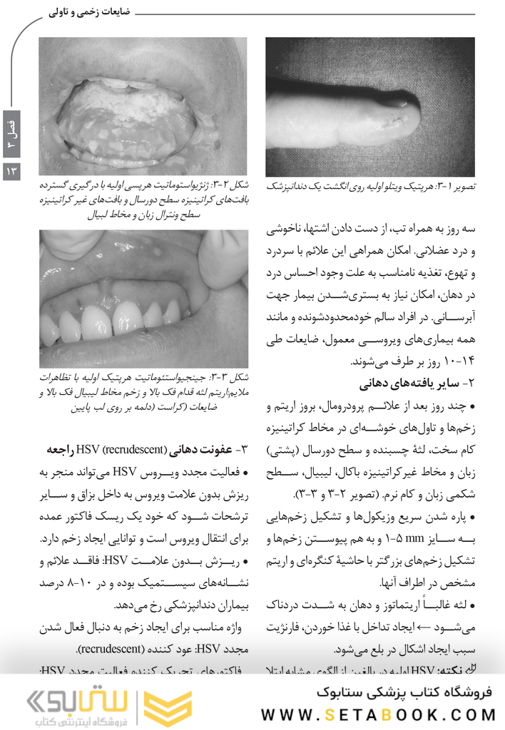 Book Brief خلاصه کتاب بیماری های دهان برکت 2021