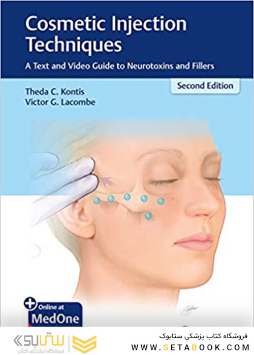 Cosmetic Injection Techniques : A Text and Video Guide to Neurotoxins and Fillers