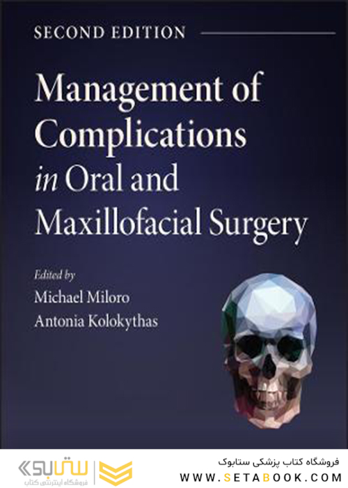 Management of Complications in Oral and Maxillofacial Surgery 2nd Edición