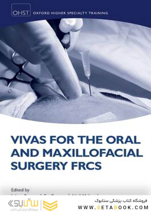 Vivas for the Oral and Maxillofacial Surgery FRCS