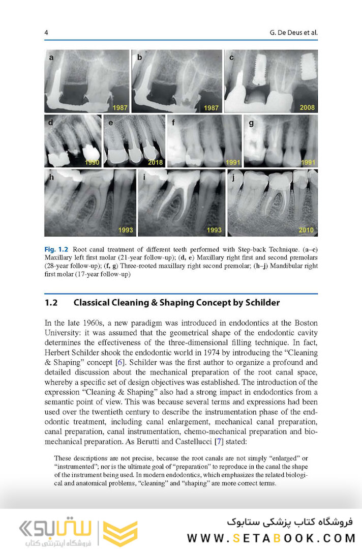 Shaping for Cleaning the Root Canals : A Clinical-Based Strategy 2022