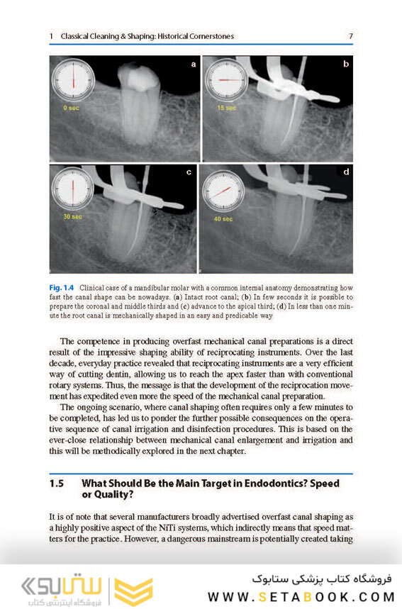 Shaping for Cleaning the Root Canals : A Clinical-Based Strategy 2022