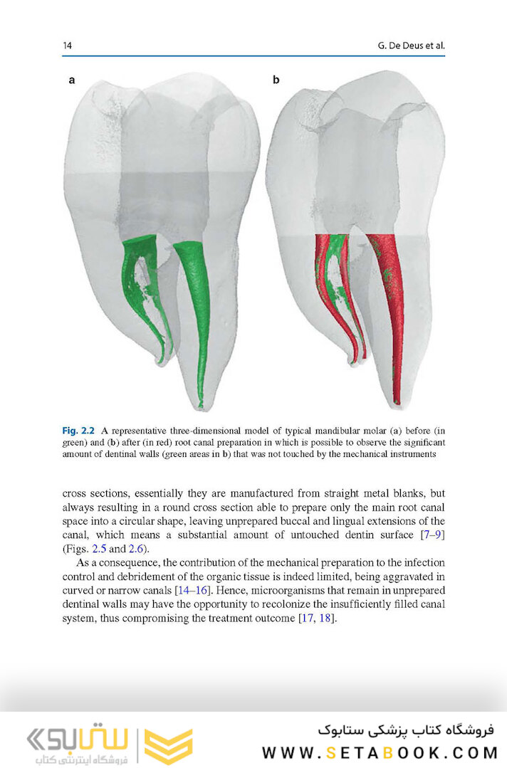Shaping for Cleaning the Root Canals : A Clinical-Based Strategy 2022