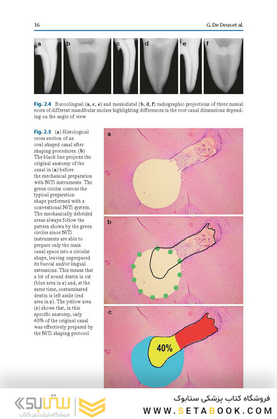Shaping for Cleaning the Root Canals : A Clinical-Based Strategy 2022