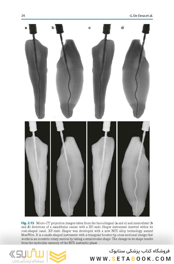 Shaping for Cleaning the Root Canals : A Clinical-Based Strategy 2022