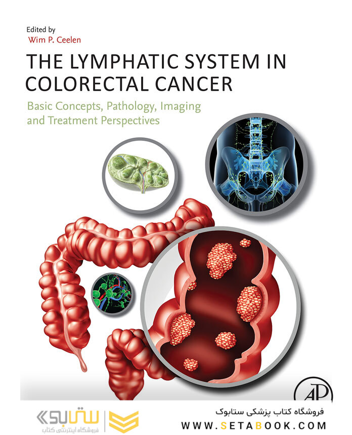 The Lymphatic System in Colorectal Cancer : Basic Concepts, Pathology, Imaging, and Treatment Perspectives