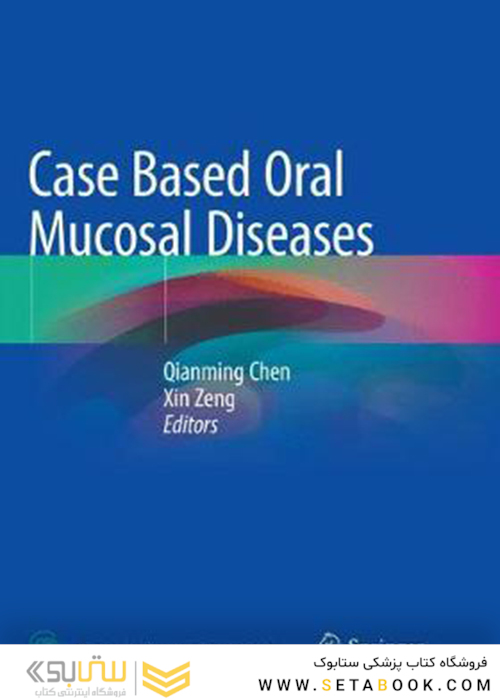 Case Based Oral Mucosal Diseases 1st ed. 2018 Edición