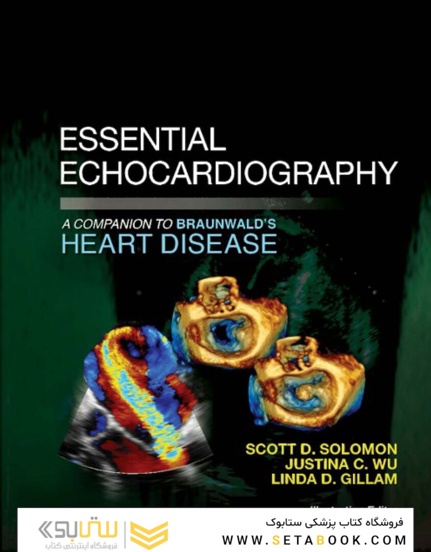 Essential Echocardiography: A Companion to Braunwald’s Heart Disease 1st Edicion