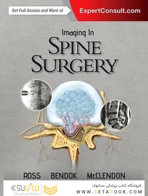 Imaging in Spine Surgery 1st Edición
