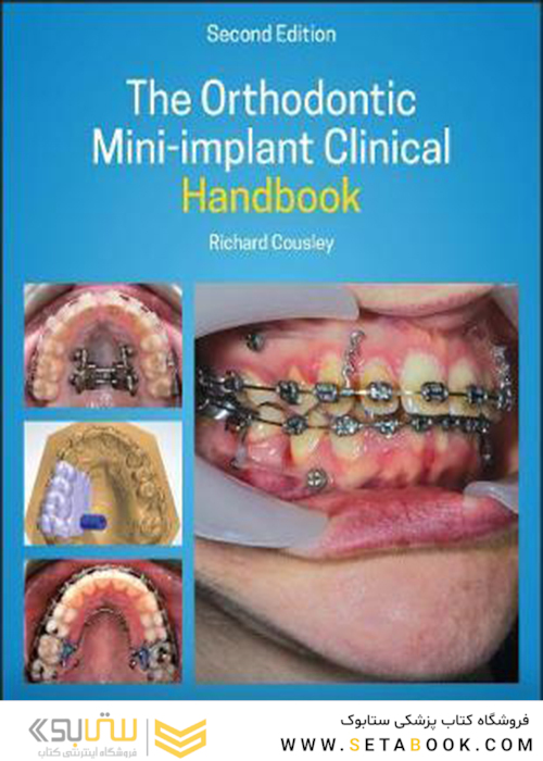 The Orthodontic Mini-implant Clinical Handbook 2nd Edition, Kindle Edition 2020