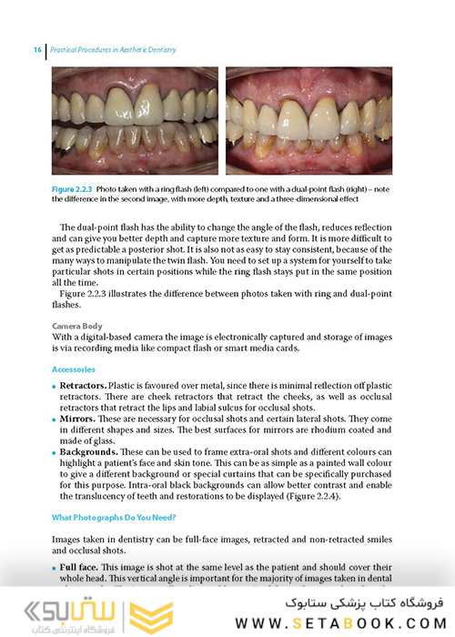 Practical Procedures in Aesthetic Dentistry