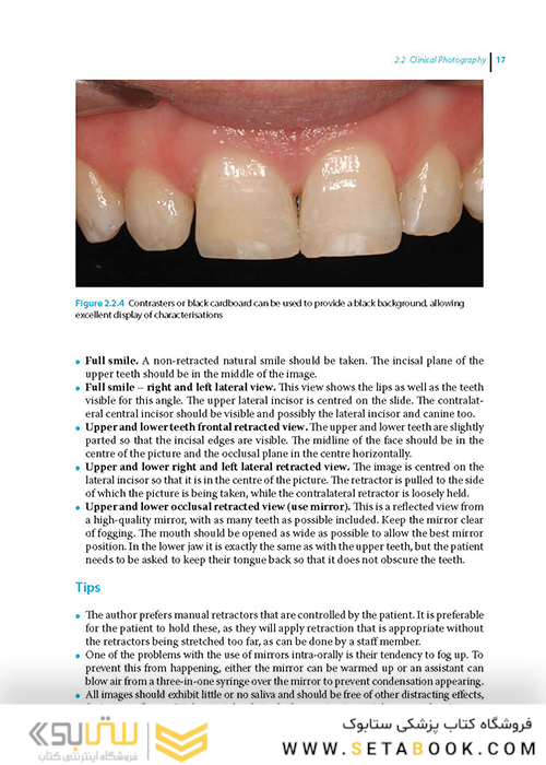 Practical Procedures in Aesthetic Dentistry