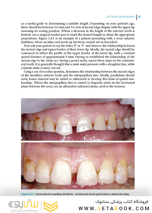 Practical Procedures in Aesthetic Dentistry