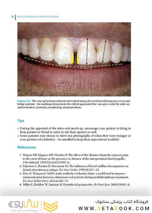 Practical Procedures in Aesthetic Dentistry