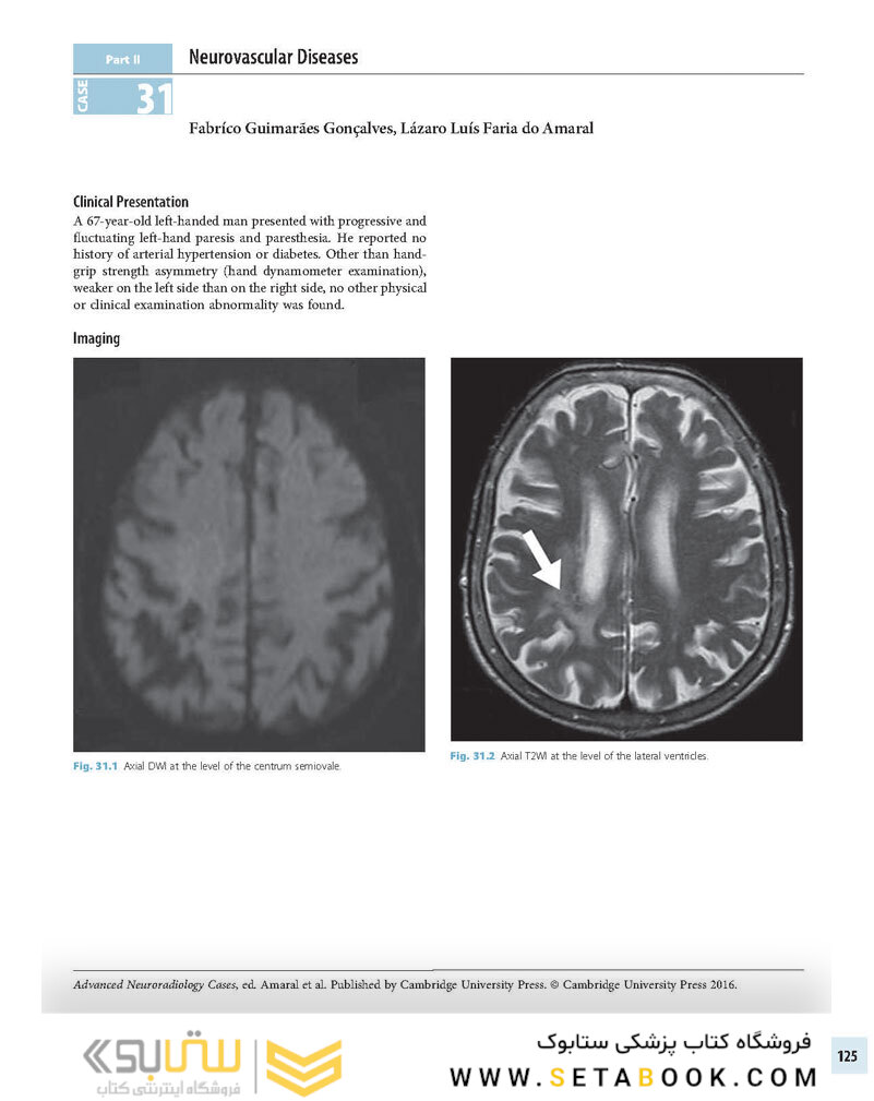 Advanced Neuroradiology Cases: Challenge Your Knowledge 1st Edición