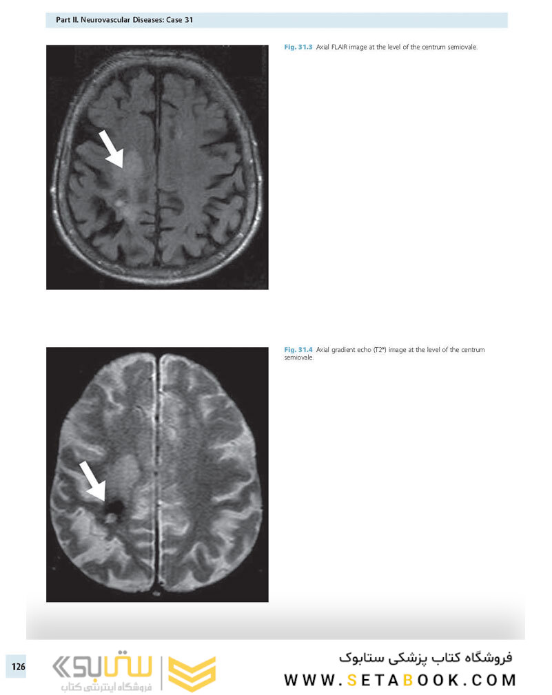 Advanced Neuroradiology Cases: Challenge Your Knowledge 1st Edición