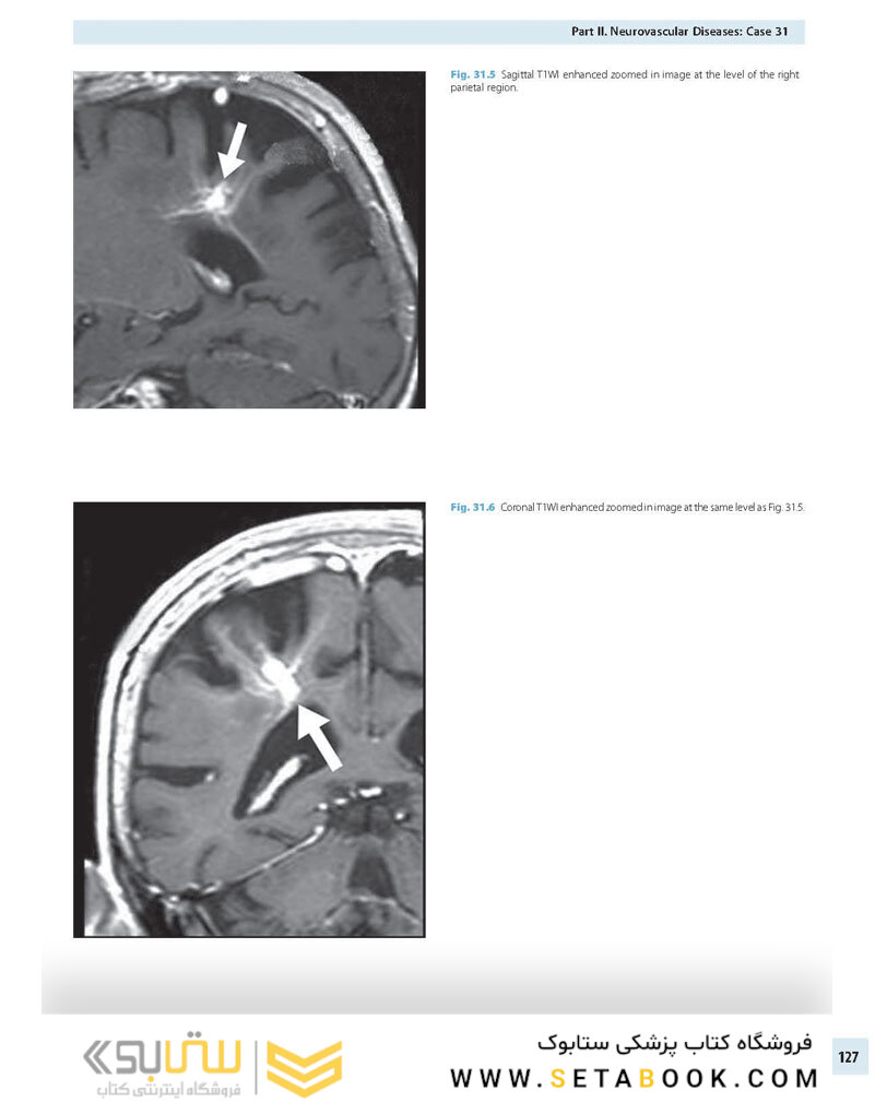Advanced Neuroradiology Cases: Challenge Your Knowledge 1st Edición