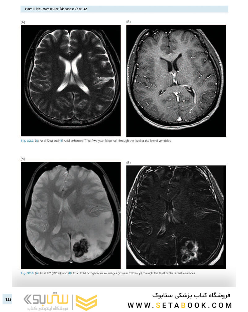 Advanced Neuroradiology Cases: Challenge Your Knowledge 1st Edición