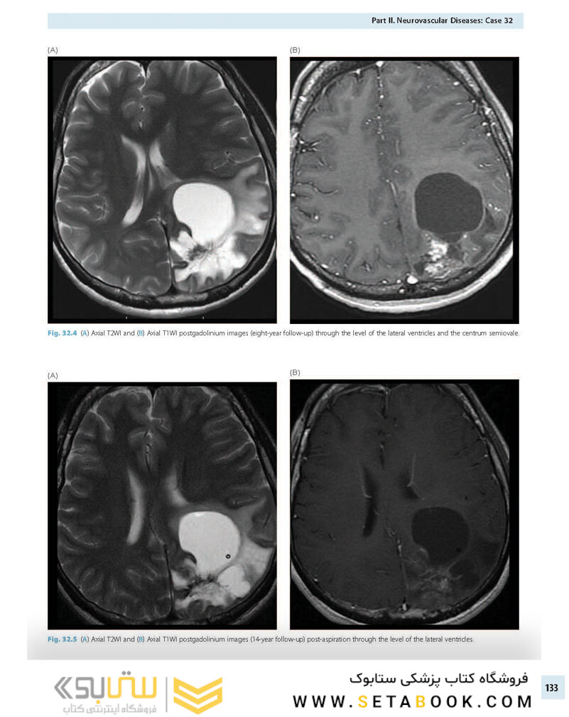 Advanced Neuroradiology Cases: Challenge Your Knowledge 1st Edición