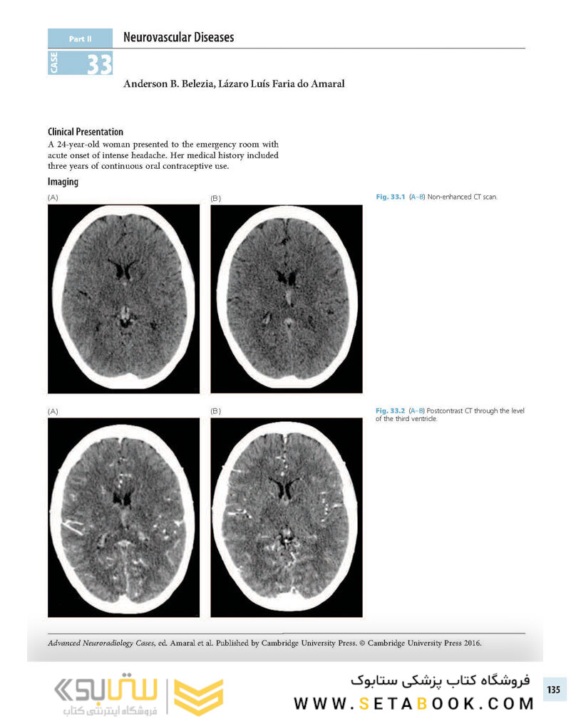 Advanced Neuroradiology Cases: Challenge Your Knowledge 1st Edición