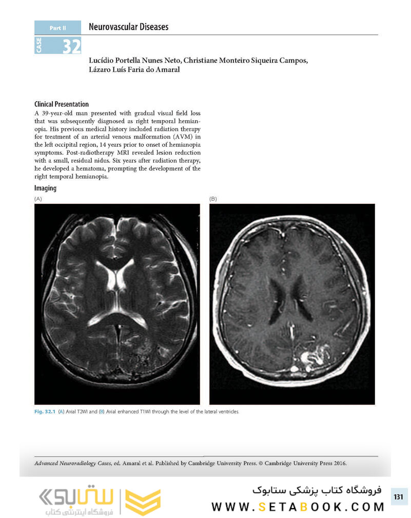 Advanced Neuroradiology Cases: Challenge Your Knowledge 1st Edición