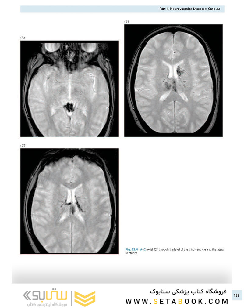 Advanced Neuroradiology Cases: Challenge Your Knowledge 1st Edición