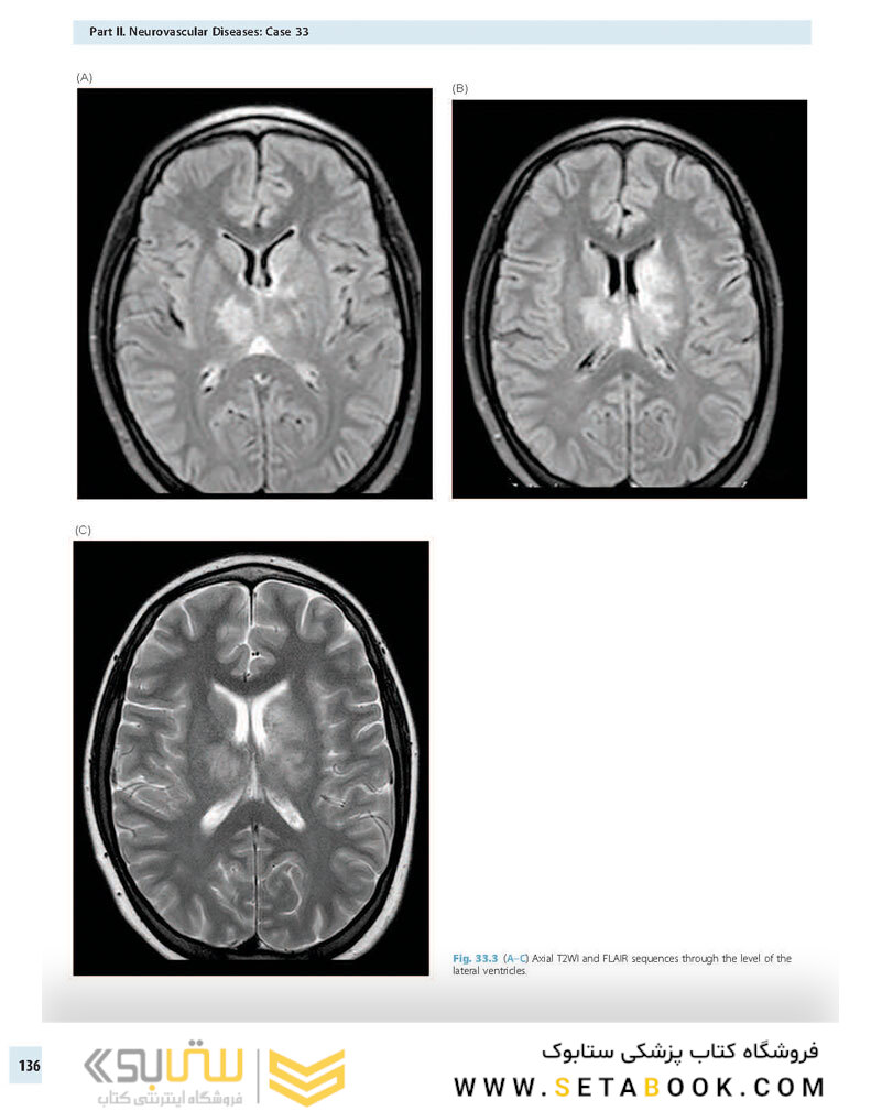 Advanced Neuroradiology Cases: Challenge Your Knowledge 1st Edición