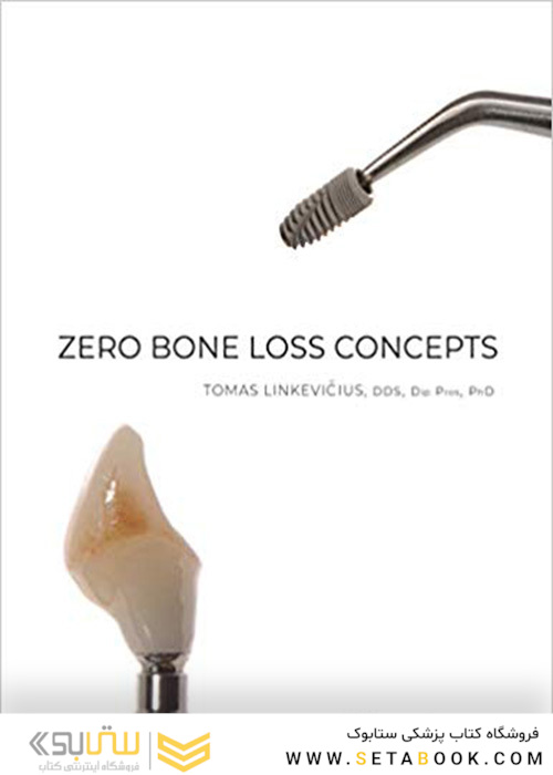 Zero Bone Loss Concepts 1st Edition 2019