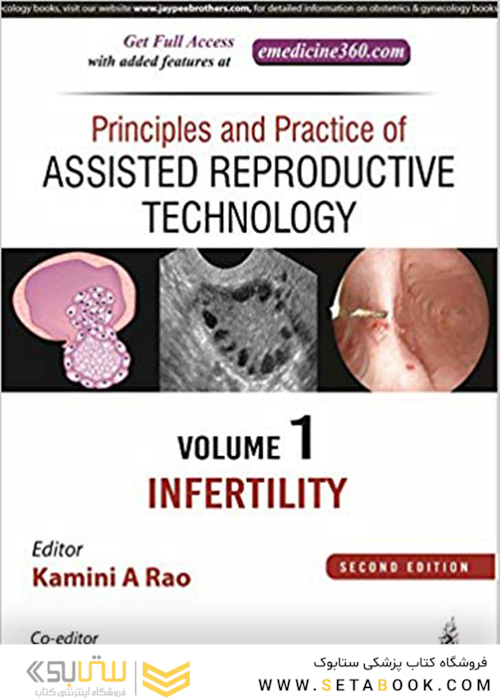 Principles and Practice of Assisted Reproductive Technology : Three Volume Set 2018