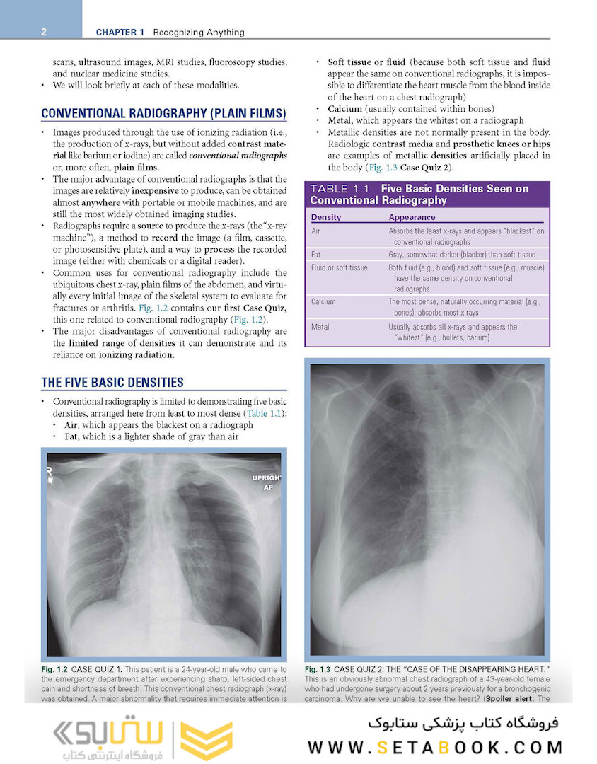 Learning Radiology: Recognizing the Basics 4th Edition