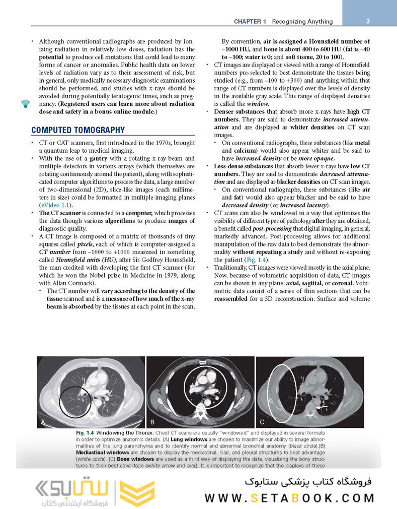 Learning Radiology: Recognizing the Basics 4th Edition