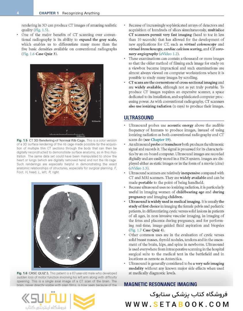 Learning Radiology: Recognizing the Basics 4th Edition