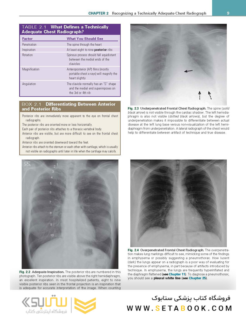 Learning Radiology: Recognizing the Basics 4th Edition