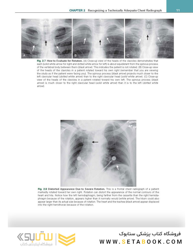 Learning Radiology: Recognizing the Basics 4th Edition