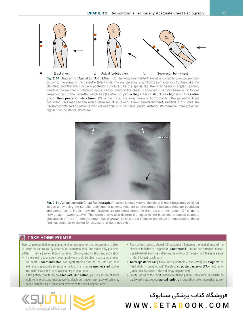 Learning Radiology: Recognizing the Basics 4th Edition