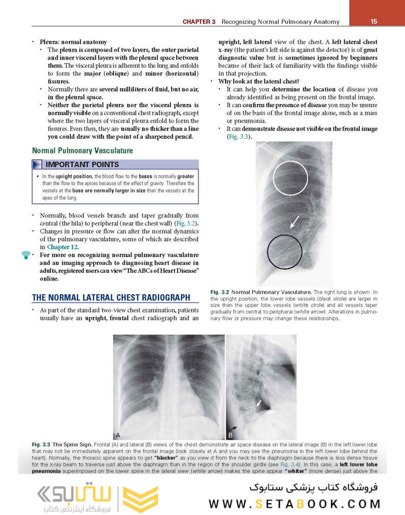 Learning Radiology: Recognizing the Basics 4th Edition