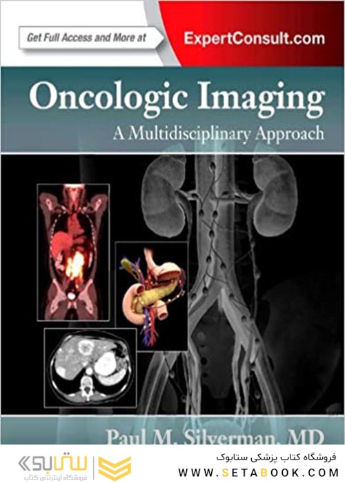 Oncologic Imaging: A Multidisciplinary Approach: Expert Consult - Online and Print