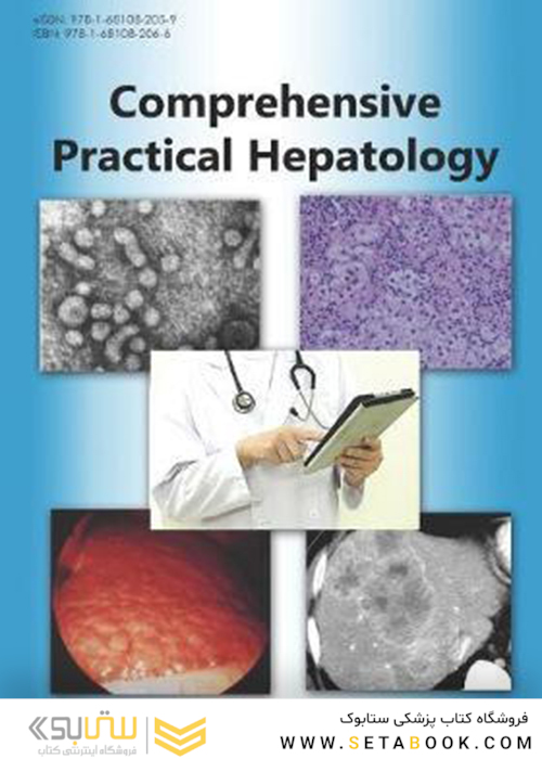 Comprehensive Practical Hepatology