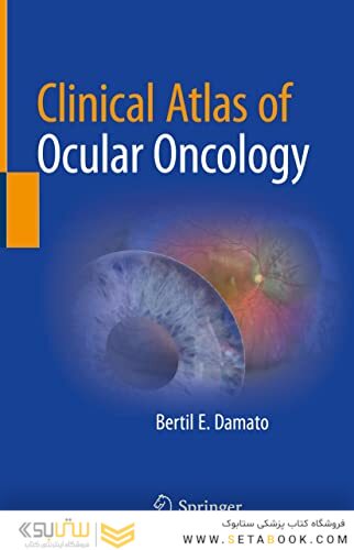 Clinical Atlas of Ocular Oncology
