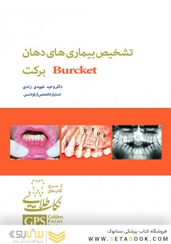 gps نکات طلایی تشخیص بیماری های دهان برکت